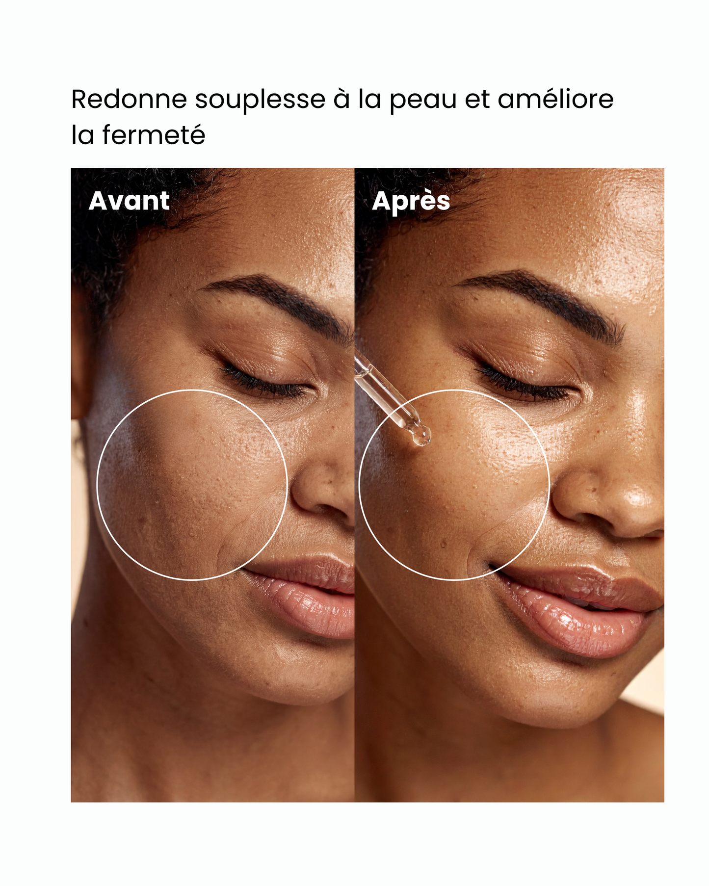 Sérum hydratant – Redonne souplesse à la peau et améliore la fermeté