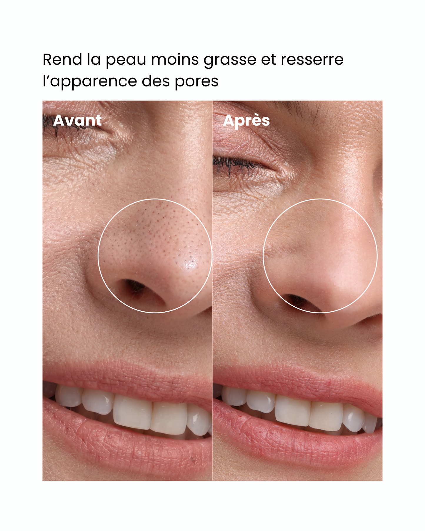 Sérum unifiant – Rend la peau moins grasse et resserre l’apparence des pores