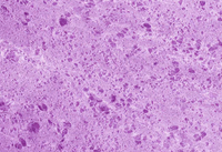 Tocophérol (Vitamine E)